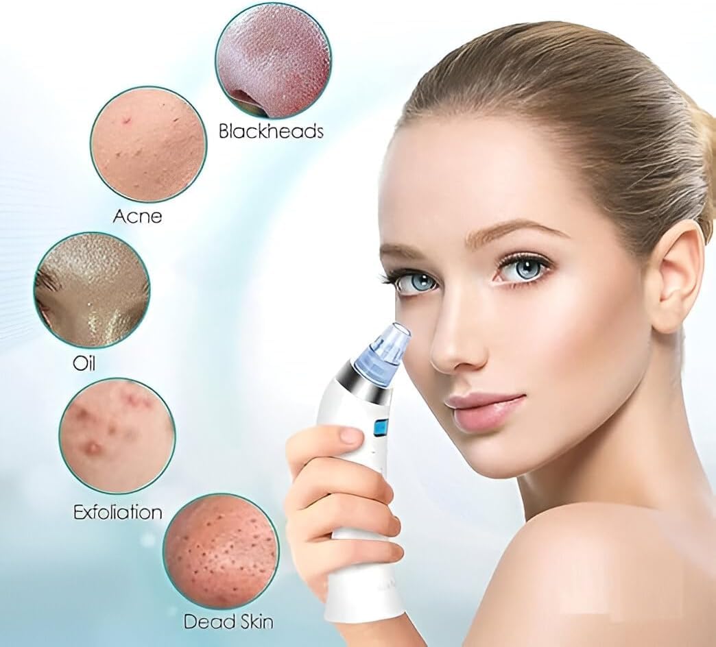 Derma Suction Blackhead Remover