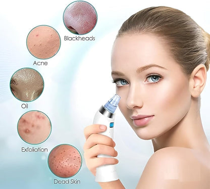 Derma Suction Blackhead Remover