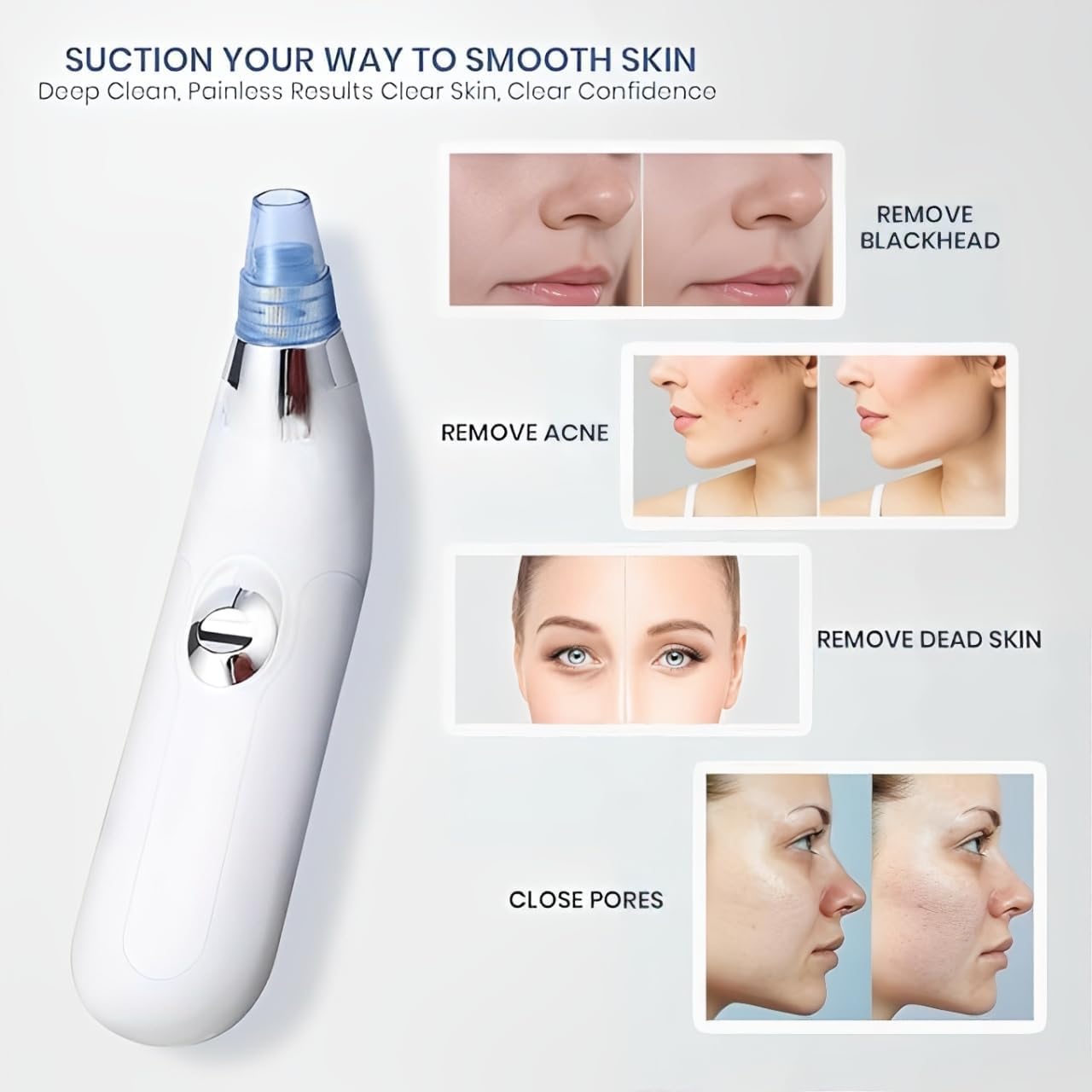 Derma Suction Blackhead Remover