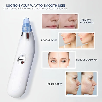 Derma Suction Blackhead Remover