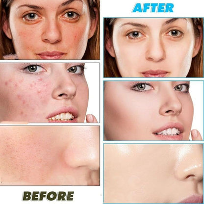 Turmeric and Kojic Acid Face Cleansing Pads