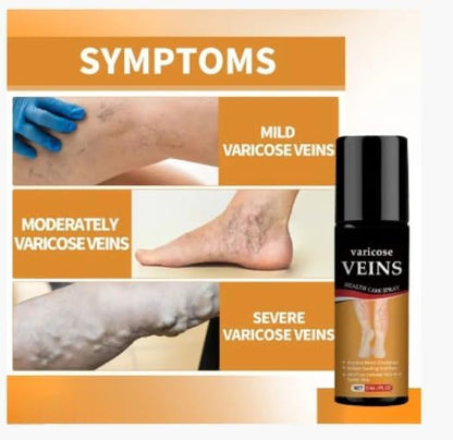 Varicose Veins Spray